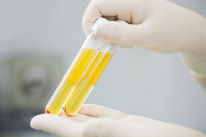 Why Plasma Donation is Important to Public Health